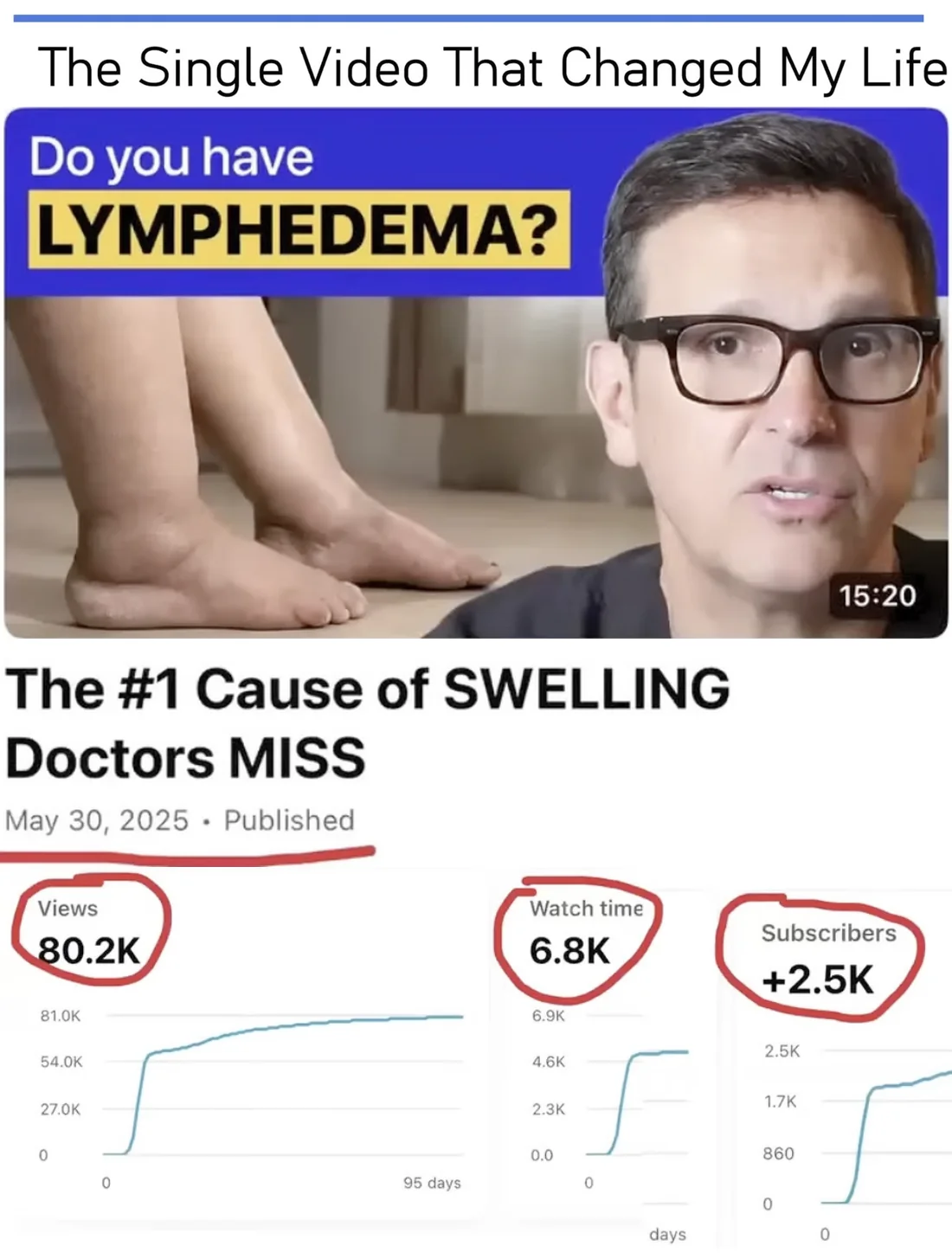 Dr. John Chuback's slide titled The Single Video That Changed My Life: his video The #1 Cause of Swelling Doctors Miss, published May 30, 2025, with its YouTube Studio analytics circled: 80.2K views, 6.8K watch-time hours and +2.5K subscribers